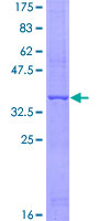 12.5% SDS-PAGE Stained with Coomassie Blue.